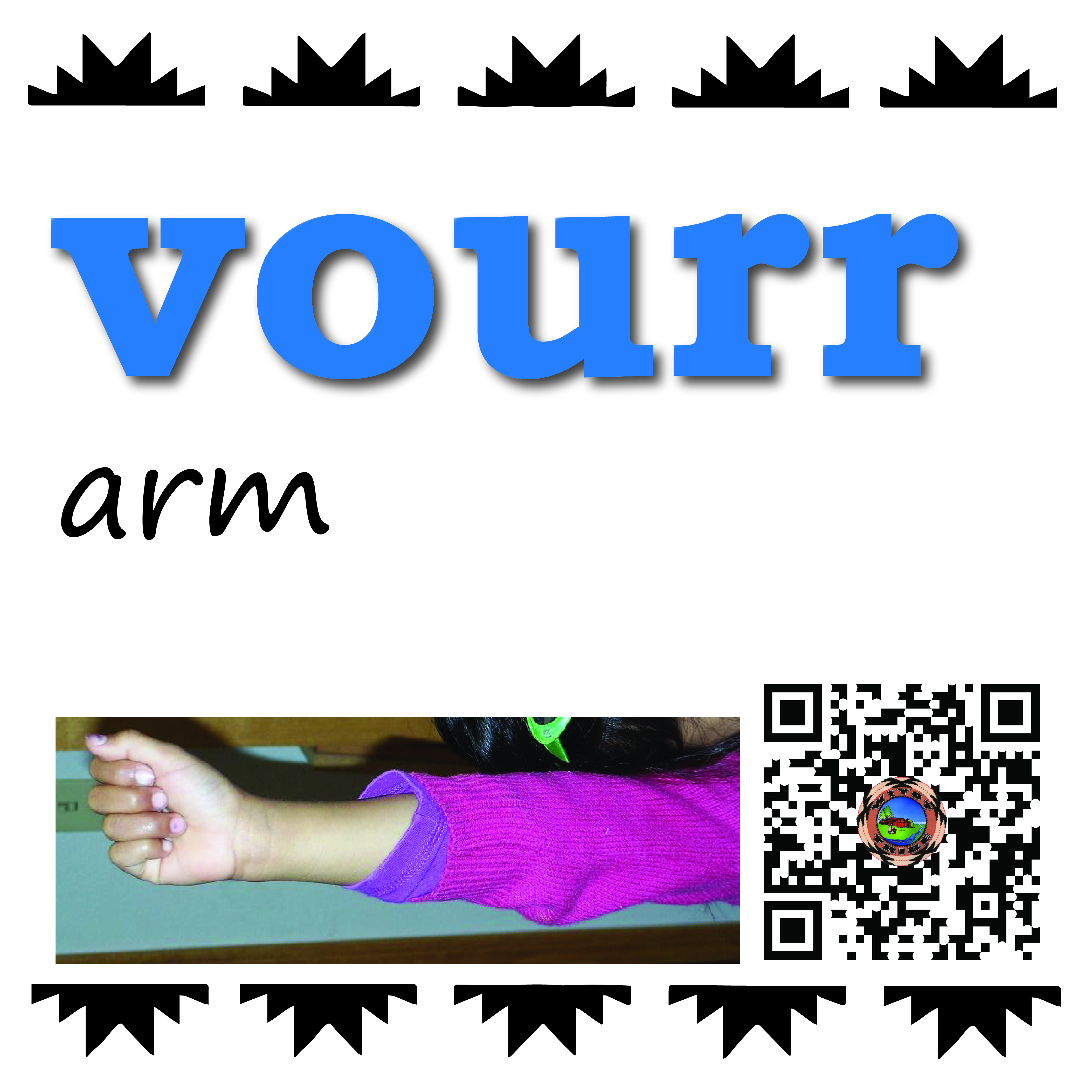 vourr_arm