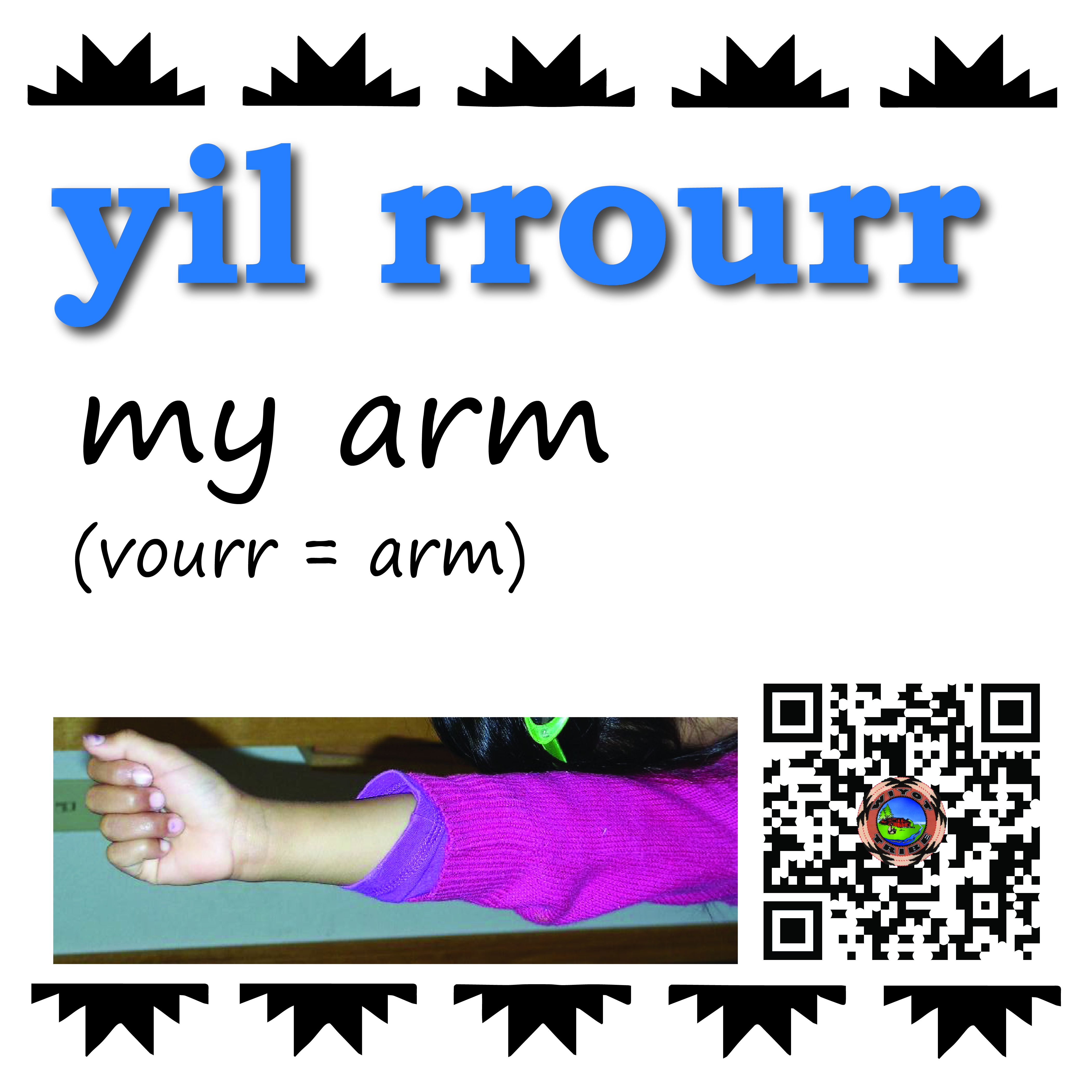 yil_rrourr_my_arm